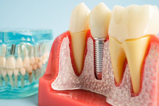 Best Preventive Dentistry  in Mccook, NE